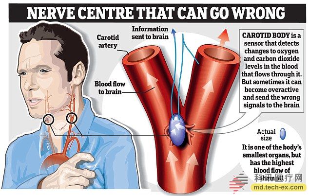 Nerve centre that can go wrong